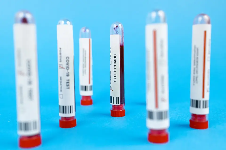 Row of identically prepared test samples